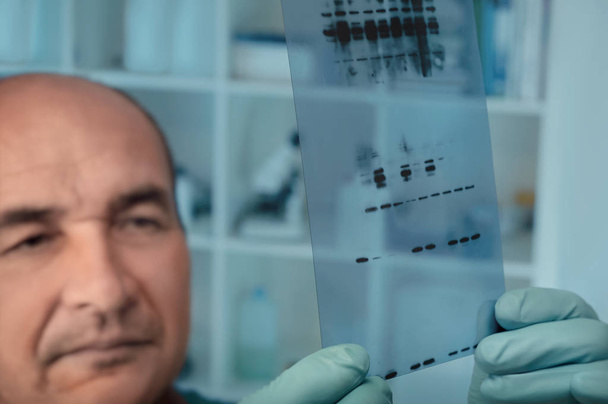 Cientista sênior verifica os resultados da análise de manchas de proteínas no filme de raios X
 - Foto, Imagem