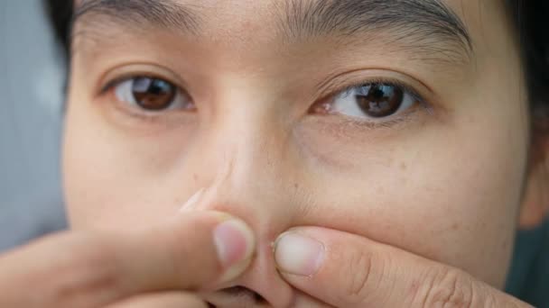 Közelkép egy fiatal nőről, aki a pattanását szorongatja az orrán, és eltávolítja a pattanásokat az arcáról. A női bőrápolás fogalma. - Felvétel, videó