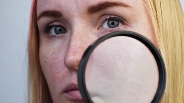 Uitgebreide rosacea, poriën, zwarte vlekken, acne, close-up op de neus. Een vrouw wordt onderzocht door een dokter. Dermatoloog onderzoekt de huid door een vergrootglas, een vergrootglas  - Video