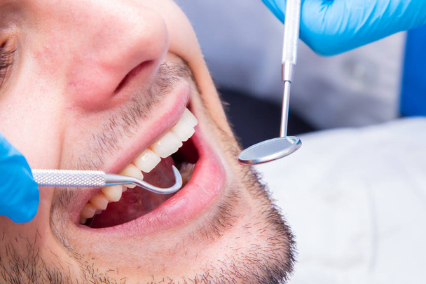 primer plano de las herramientas del dentista en la boca del paciente
 - Foto, Imagen