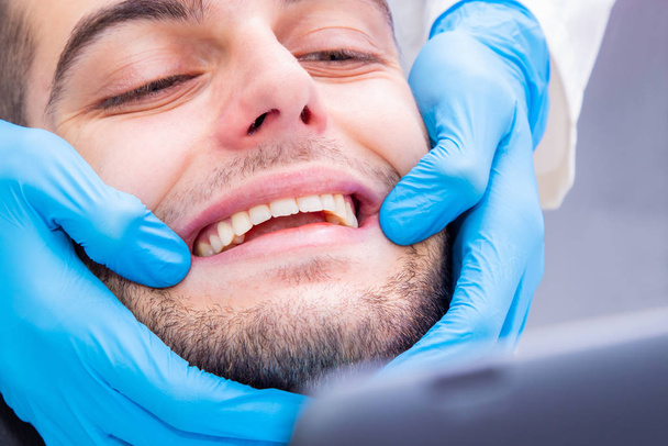стоматолог, що показує посмішку або зуби пацієнта
 - Фото, зображення
