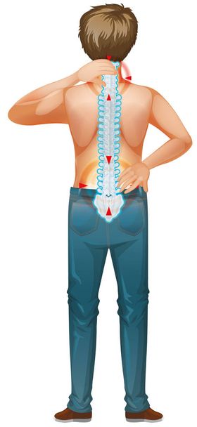 Back of man and his back pain - Vector, Image