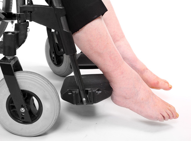 νόσου στα πόδια της μια ηλικιωμένη γυναίκα παραπληγικός κάθεται σε μια αναπηρική καρέκλα. - Φωτογραφία, εικόνα