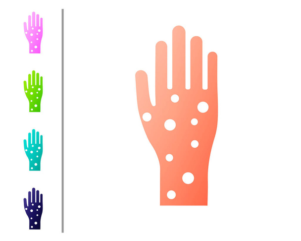 Коралловая рука с псориазом или иконой экземы изолированы на белом фоне. Концепция реакции кожи человека на аллерген или хроническую проблему организма. Задайте цвет. Векторная миграция
 - Вектор,изображение