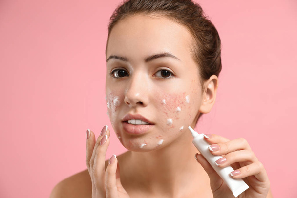 Teen girl with acne problem applying cream on light pink backgro - Fotoğraf, Görsel