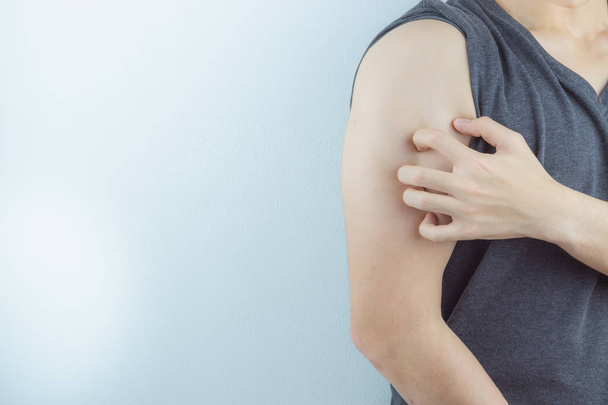 Mann kratzt sich mit der Hand am juckenden Arm mit allergischem Ausschlag  - Foto, Bild