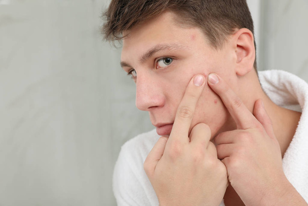 Teen guy with acne problem squeezing pimple in bathroom, closeup - Фото, зображення