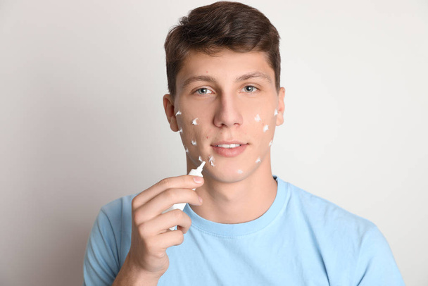 Teen guy with acne problem applying cream on light background - Fotografie, Obrázek