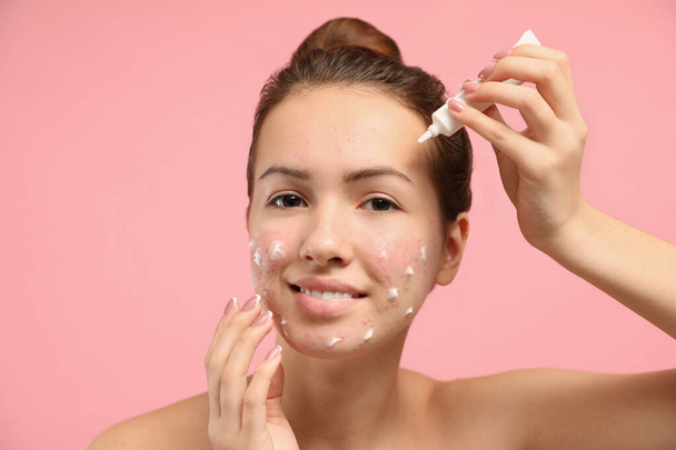 Teen girl with acne problem applying cream on light pink backgro - Fotoğraf, Görsel