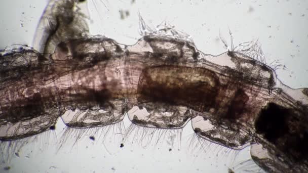 顕微鏡による蚊幼虫チロノシアの消化器系 - 映像、動画