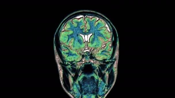 Tümörleri tespit etmek için beyin ve kafanın çok renkli MR taramaları. Teşhis medikal aracı - Video, Çekim