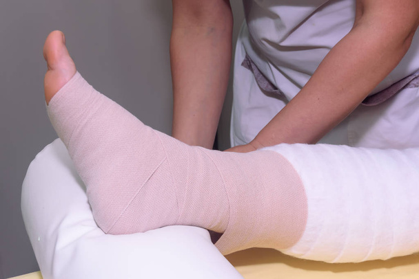 Lenf kanseri yönetimi: Lenf kanserini kontrol etmek için çok katmanlı bandaj kullanarak bacağı sarmak. Tam dekonjestif tedavi (cdt) ve manuel lenfatik drenajın bir parçası (Mld) - Fotoğraf, Görsel