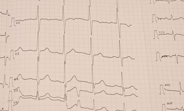 Cardiogram - Foto, afbeelding