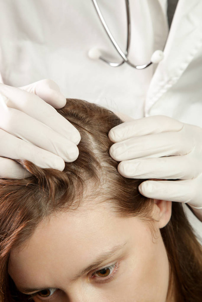 女性の髪の頭皮を調べる医師,頭皮湿疹,皮膚炎,乾癬,脱毛,ふけや乾燥頭皮の問題 - 写真・画像