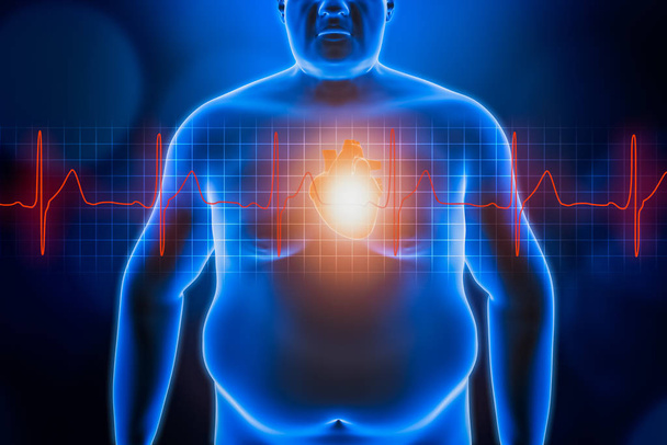 Λίπος ή παχύσαρκος άνθρωπος σώμα στο στήθος με την καρδιά και κόκκινο ekg καμπύλη της καρδιάς. Μπλε φουτουριστικό ολόγραμμα τρισδιάστατη απεικόνιση. Η παχυσαρκία, η υγειονομική περίθαλψη, ιατρική, ευεξία, καρδιακές παθήσεις έννοιες. - Φωτογραφία, εικόνα