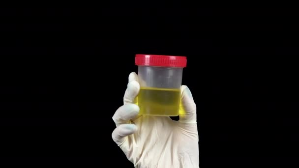 Urine in een testpot close-up. De dokter houdt een pot in een handschoen op een zwarte achtergrond. - Video