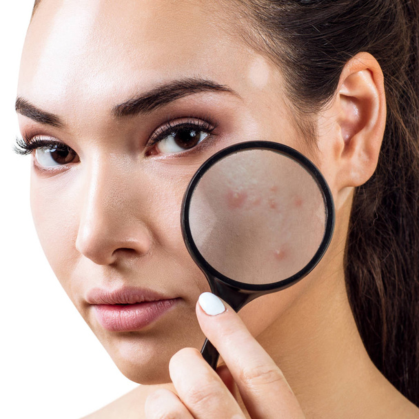 Jonge vrouw met Vergrootglas toont de huid met acne. - Foto, afbeelding