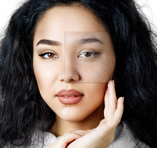 Квадратная часть показывает проблемы с кожей до и после макияжа
. - Фото, изображение