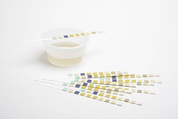 Urine Reagent Test Strips And Specimen - Photo, Image