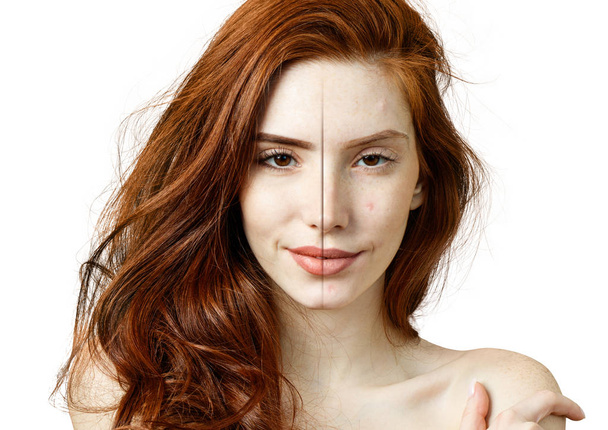 Sivilce ve makyaj öncesi ve sonrası kızıl saçlı kadın.. - Fotoğraf, Görsel