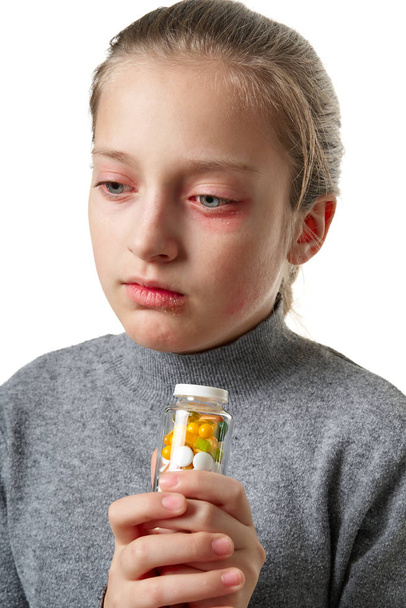 Αλλεργική αντίδραση, δερματικό εξάνθημα, κοντινό πορτραίτο προσώπου κοριτσιού. Ερυθρότητα και φλεγμονή του δέρματος στα μάτια και τα χείλη. Ασθένεια του ανοσοποιητικού συστήματος. Φιάλη δισκίων και χαπιών στο παιδικό χέρι. - Φωτογραφία, εικόνα