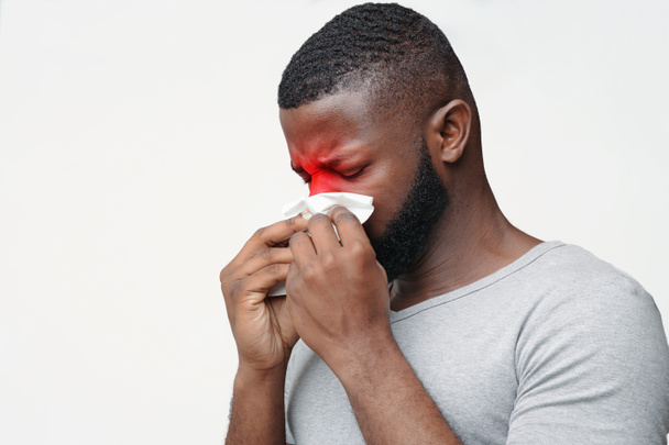Junger Mann mit Nasennebenhöhlenentzündung berührt Nase mit Serviette - Foto, Bild