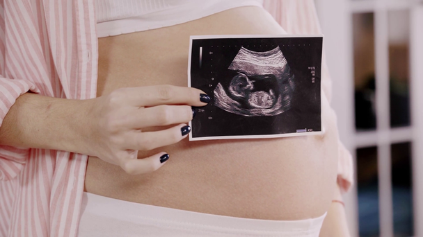 Ausgeschnittene Ansicht einer schwangeren Frau, die ein Ultraschallbild des Fötus in der Nähe des Bauches zeigt - Filmmaterial, Video