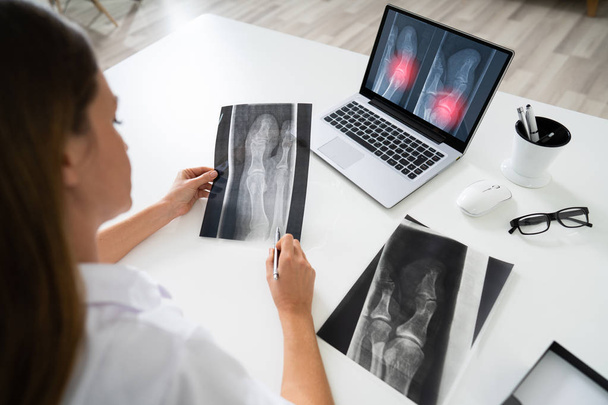 Female Doctor Examining Knee X-ray On Laptop In Clinic - Foto, afbeelding