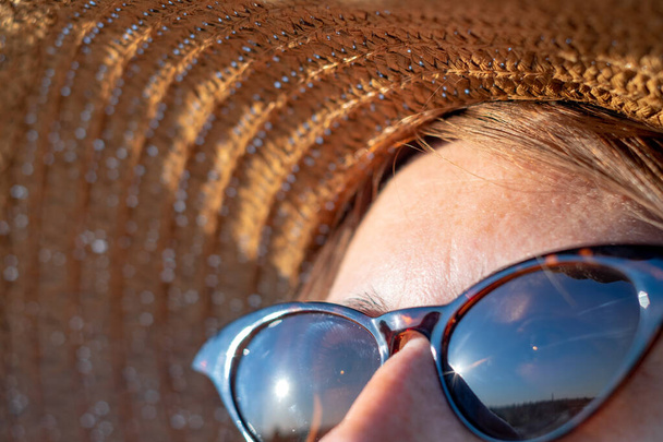 Forehead of a woman with freckles in direct sunlight, close-up view. UV protection, sun radiation concept: skin with lentigo in the summer sun - Zdjęcie, obraz