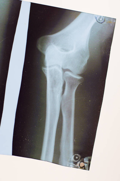 x-ray eklem resmi - Fotoğraf, Görsel