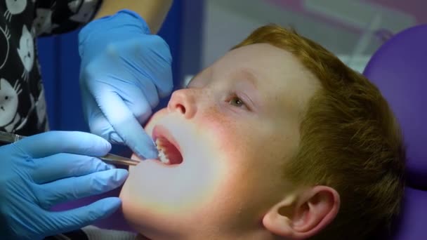 Scared red-haired boy crying at reception at dentist in dental chair. Pediatric dentistry - Felvétel, videó