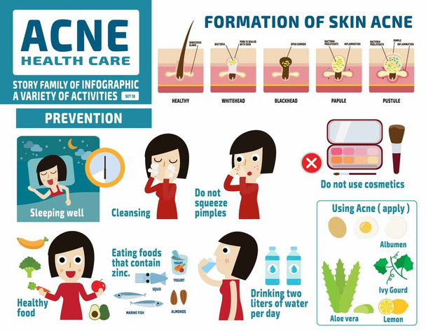 acne en beschermen. gezondheidszorgconcept. infografische elementen. plat schattig cartoon ontwerp illustratie. - Vector, afbeelding