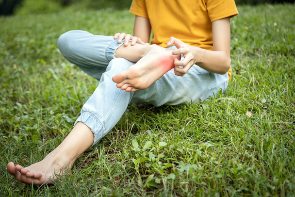 Asijské dítě dívka škrábanec na noze s rukou, nohy svědí alergie, vyrážka v trávě v parku, dospívající nenosí boty nebo chodit bosý dostane parazitický do kůže způsobit svědění nohou, anafylaxe - Fotografie, Obrázek