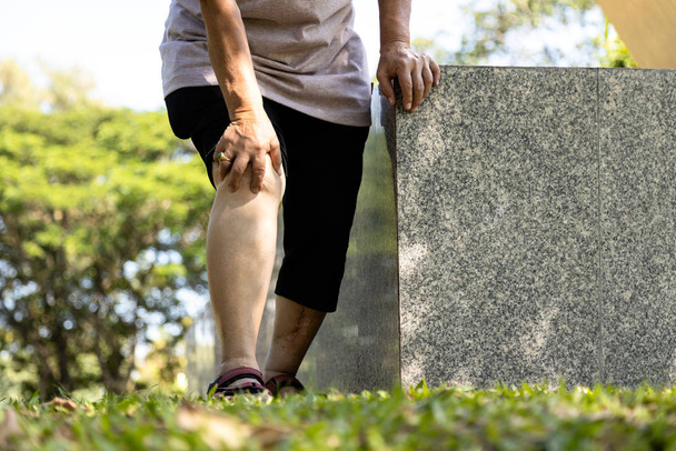 Close-up van benen van gewonde oudere vrouw hebben kniepijn, gezwollen knieën en hand om de knie te masseren tijdens het lopen, ouderen lijden aan jicht, artritis, artrose, reuma, ziekte van de ouderen  - Foto, afbeelding