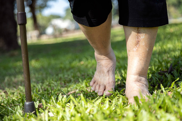 Κοντινό πλάνο των ξυπόλητων ποδιών, ασιάτισσα ηλικιωμένη γυναίκα περπατώντας ξυπόλητη στο γρασίδι το ηλιόλουστο καλοκαίρι, ηλικιωμένες γυναίκες με μπαστούνι, χαλαρώστε και άσκηση στη φύση και μόνο το πρωί, υγιεινό τρόπο ζωής  - Φωτογραφία, εικόνα