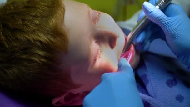 the dentist treats the teeth of a frightened redheaded boy - Materiał filmowy, wideo