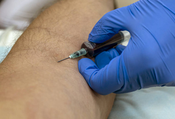 egy kék kesztyűs orvos keze vegyen vért a vénából a koronavírus vizsgálatához.  - Fotó, kép