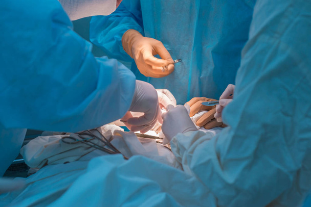Κοντινό πλάνο, μια ομάδα παιδιατρικών χειρουργών εκτελεί χειρουργική επέμβαση για λεμφαδενίτιδα αυτιών. Οι ογκολόγοι κάνουν μια παρακέντηση για διάγνωση - Φωτογραφία, εικόνα