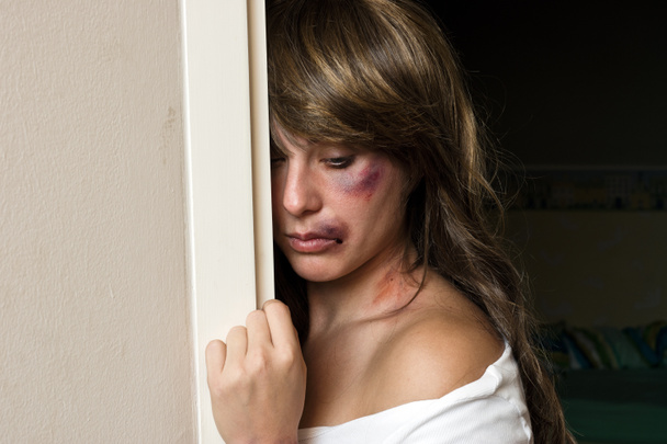 mulher com hematomas se escondendo atrás da parede
 - Foto, Imagem