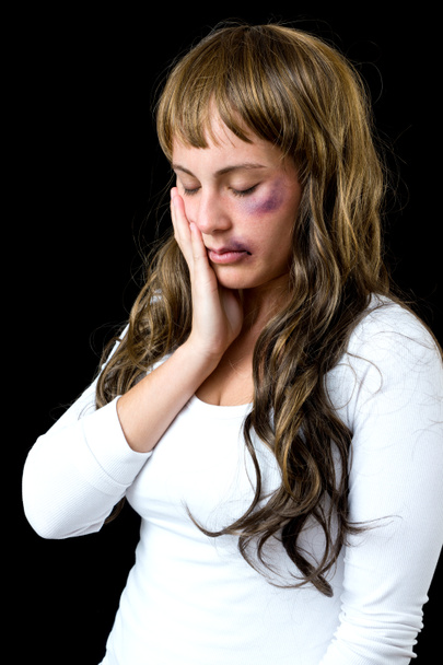 woman with bruises - Photo, Image