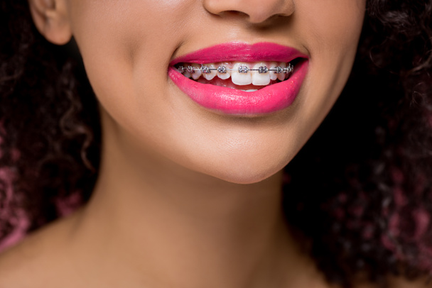 cropped view of smiling african american girl with dental braces and pink lips - Fotografie, Obrázek