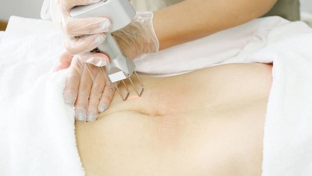 professional beauty salon worker makes laser hair removal - Foto, afbeelding