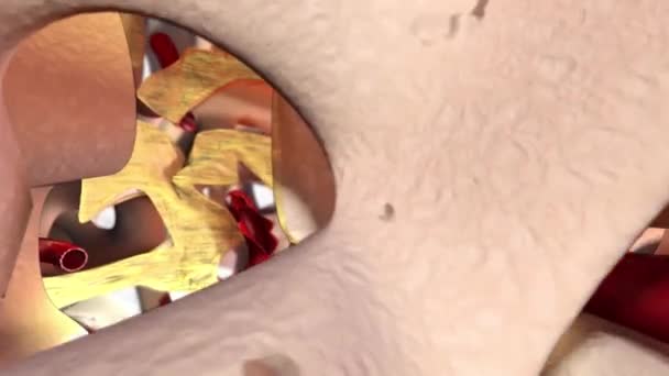 La cámara vuela en el hueso de la esponja por encima del vaso rojo de salud y muestra las paredes del agujero después de perforar el procedimiento óseo con los vasos sanguíneos que destruyeron. Vista microscópica. Animación 3D. Archivo MP4. 20 segundos
. - Imágenes, Vídeo