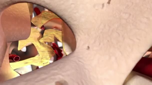 Η κάμερα πετά στα οστά πάνω από το δοχείο και πετά στον πυθμένα της τρυπημένης τρύπας μετά το τρύπημα. Στην τρύπα είναι ορατά τα αιμοφόρα αγγεία που καταστρέφονται. Οδοντιατρική 3D animation. Αρχείο mov. - Πλάνα, βίντεο