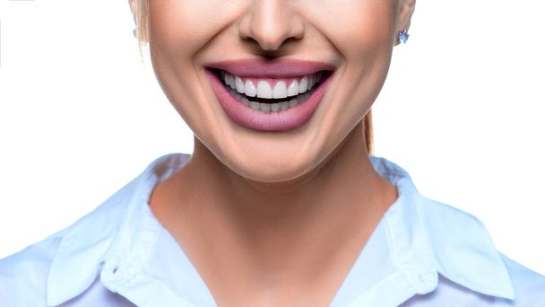 Φωτογραφία μιας χαμογελαστής γυναίκας. Έννοια λεύκανσης δοντιών. - Φωτογραφία, εικόνα