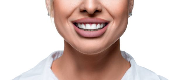 Close up photo of a smiling woman over white backgorund. Teeth whitening and dental health concept. - Photo, Image