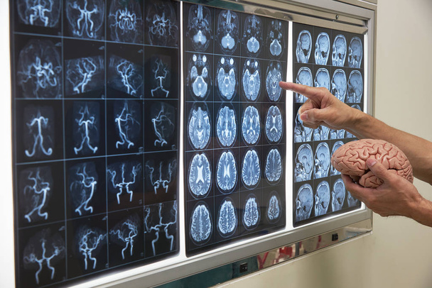 Doctor demonstrating human brain anatomy  - Photo, Image