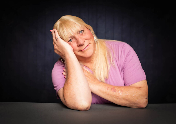 Trans Woman with Head Resting on Her Hand - Φωτογραφία, εικόνα
