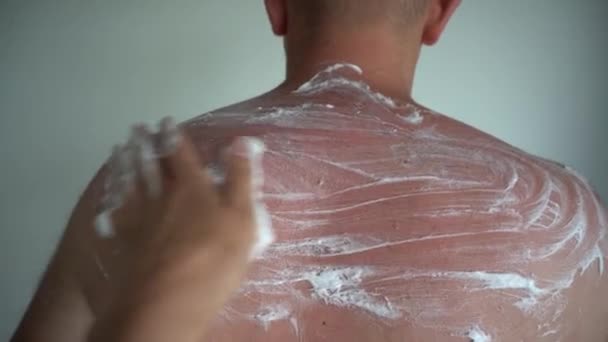 Ręcznie nanosić specjalny lek pantenol na opaloną skórę męską - Materiał filmowy, wideo
