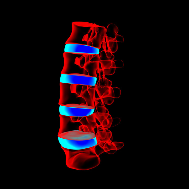 3D renderowane - struktury kręgosłupa na czarnym tle z niebieskim dysk kręgosłupa - widok z boku - Zdjęcie, obraz